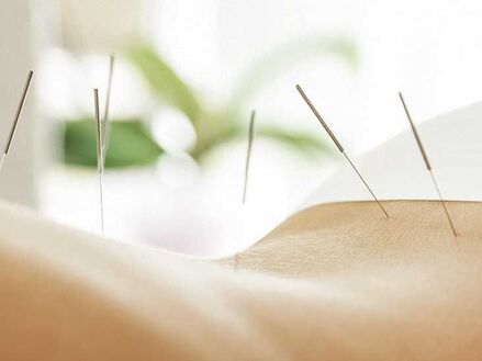 Acupuncture needles in lower back